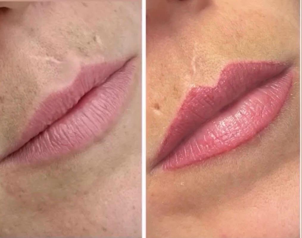 Micropigmentación de labios cicatrizada: antes y después