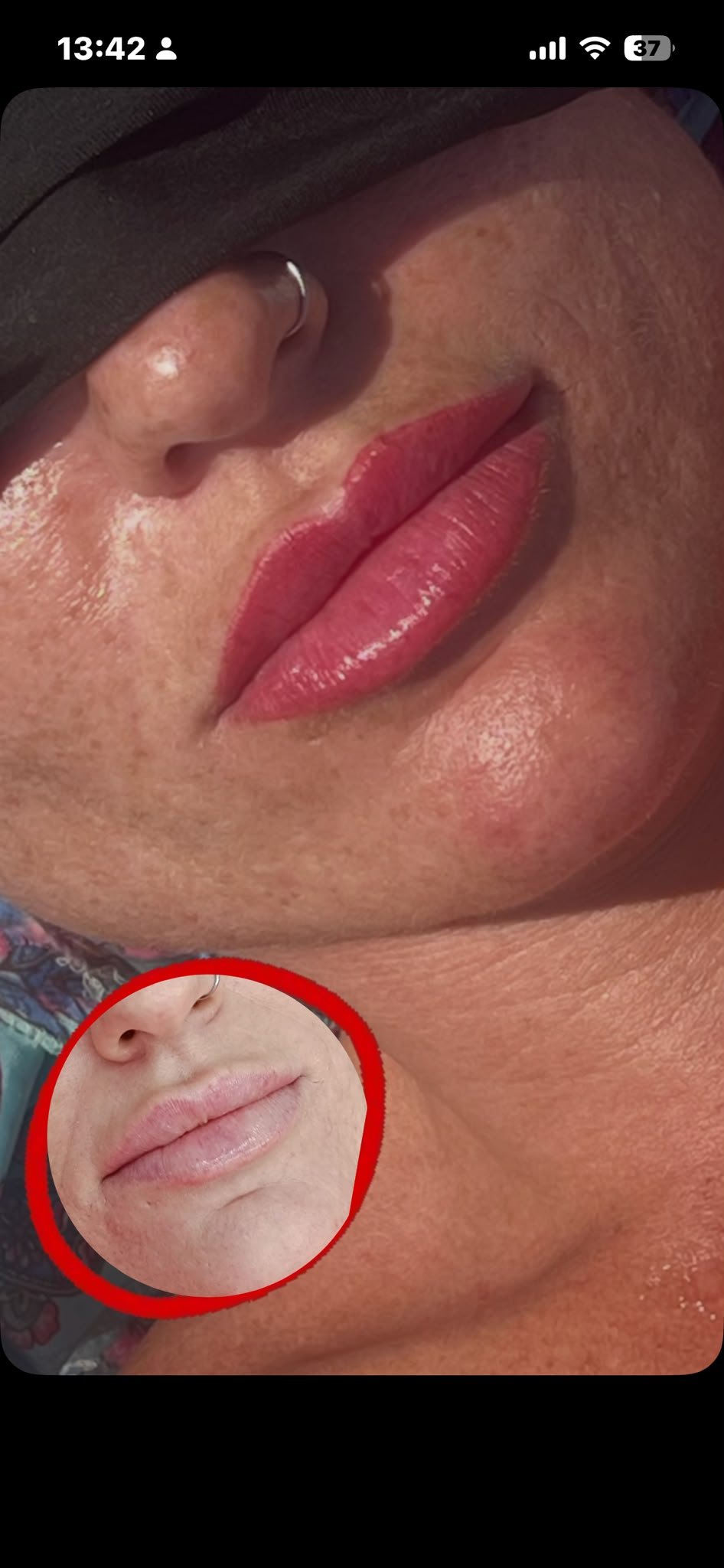 Micropigmentación de labios recién hecha y ya cicatrizada, resultado natural