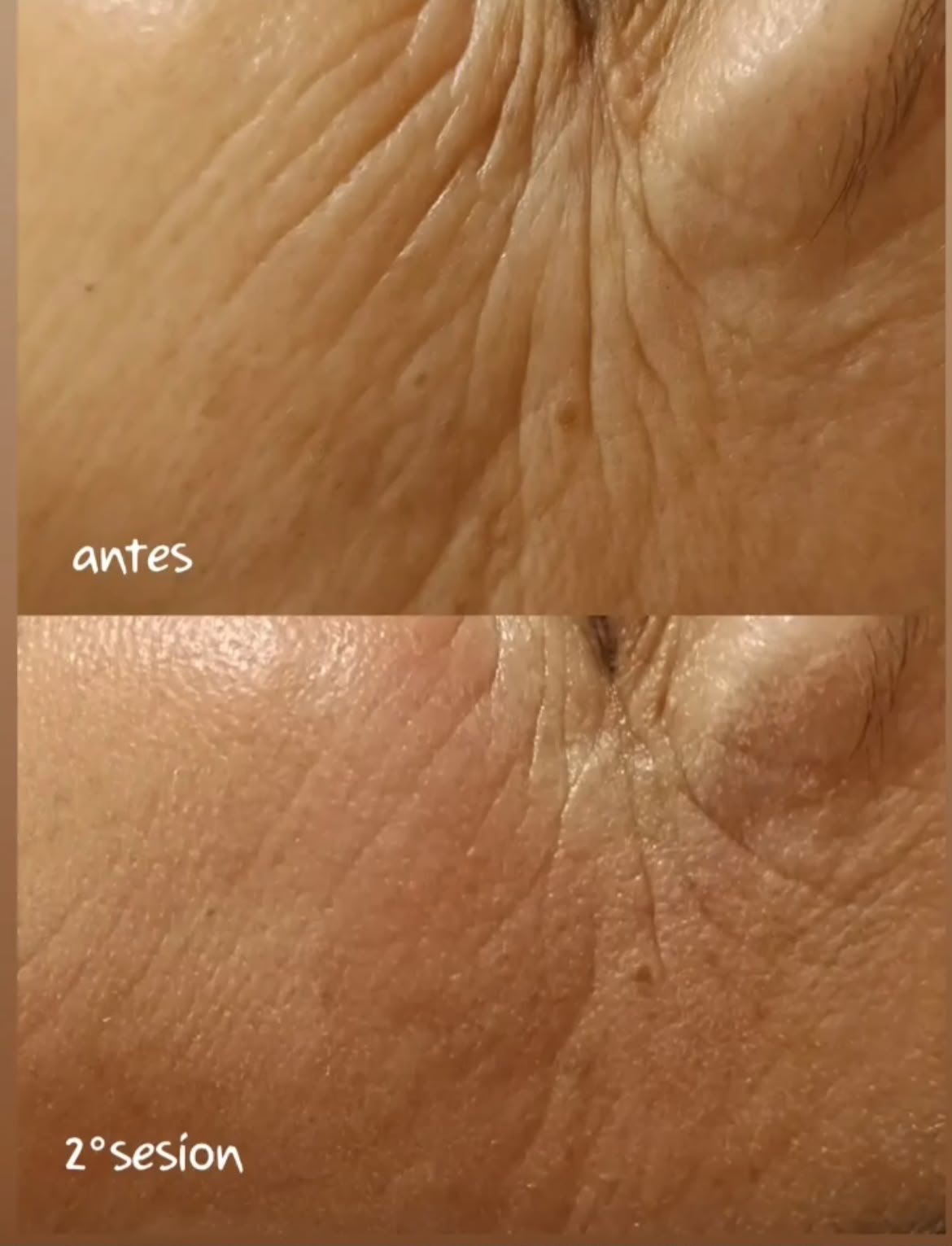 Resultado de BBGlow efecto buena cara