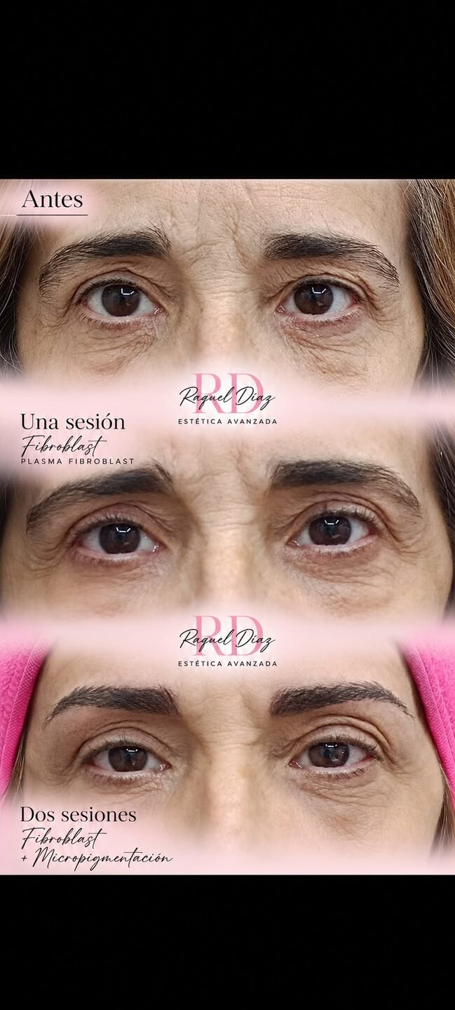 Raquel Diaz Estetica Avanzada