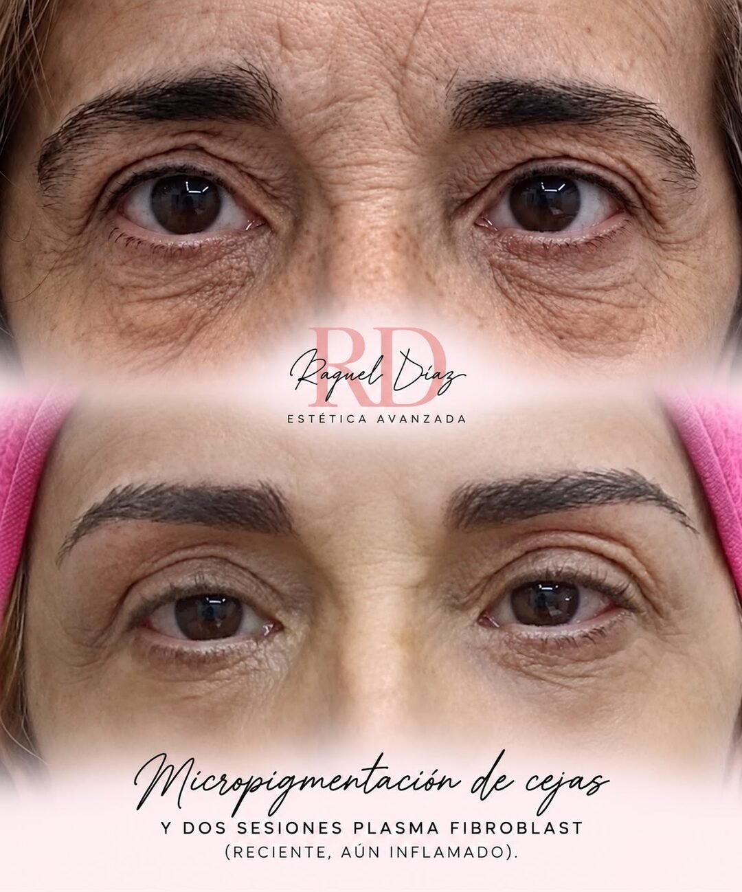 Raquel Diaz Estetica Avanzada