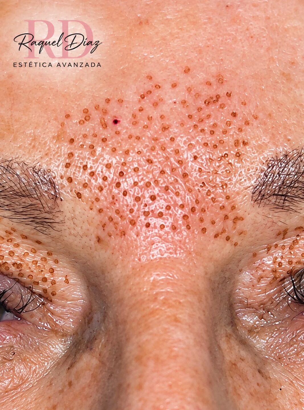 Raquel Diaz Estetica Avanzada