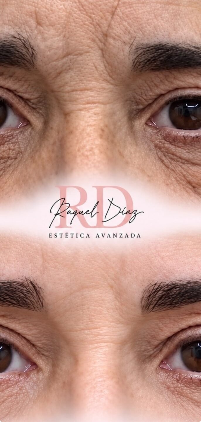 Raquel Diaz Estetica Avanzada