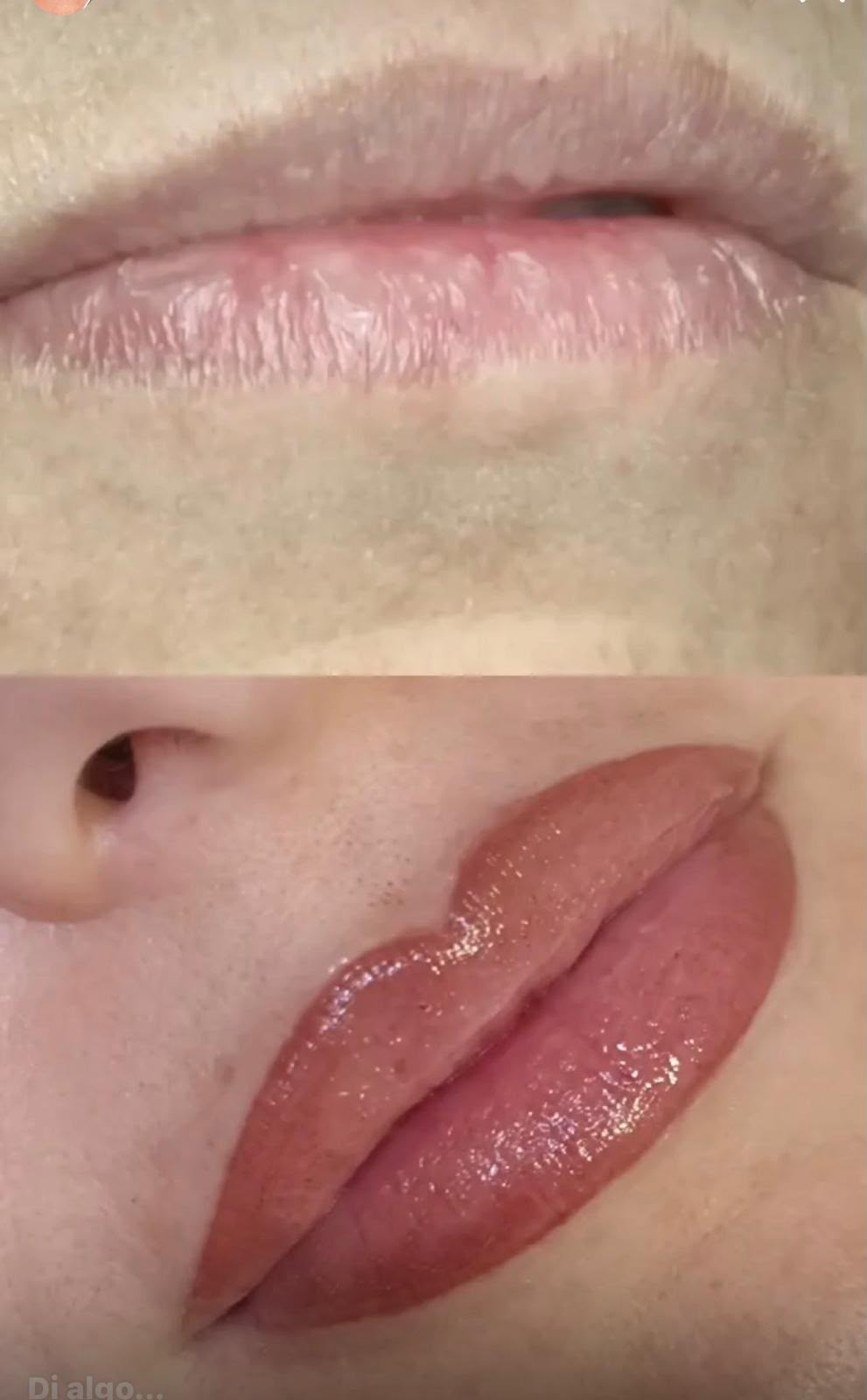 Micropigmentación de labios con ácido hialurónico: antes y después