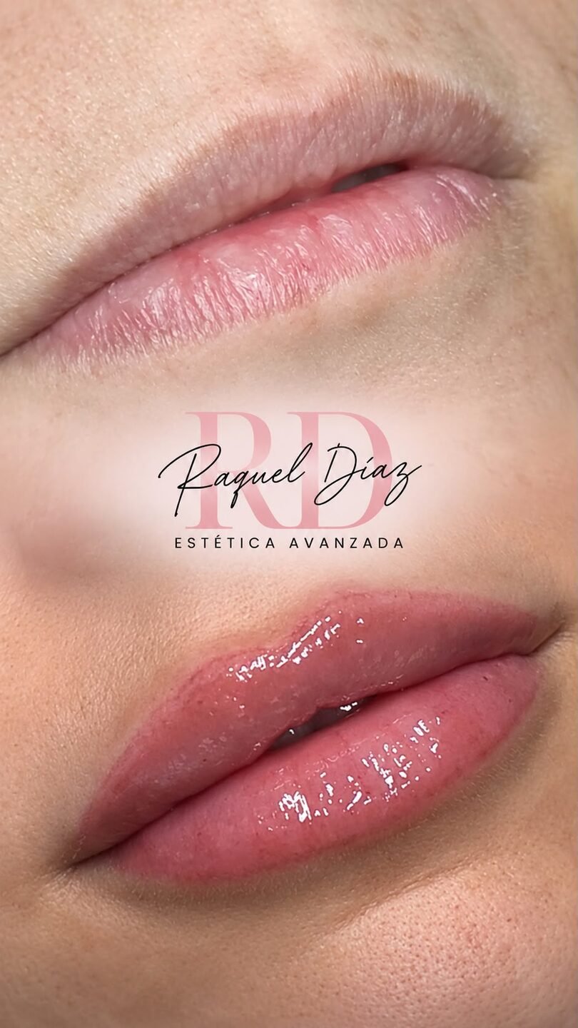 Lip Glow
