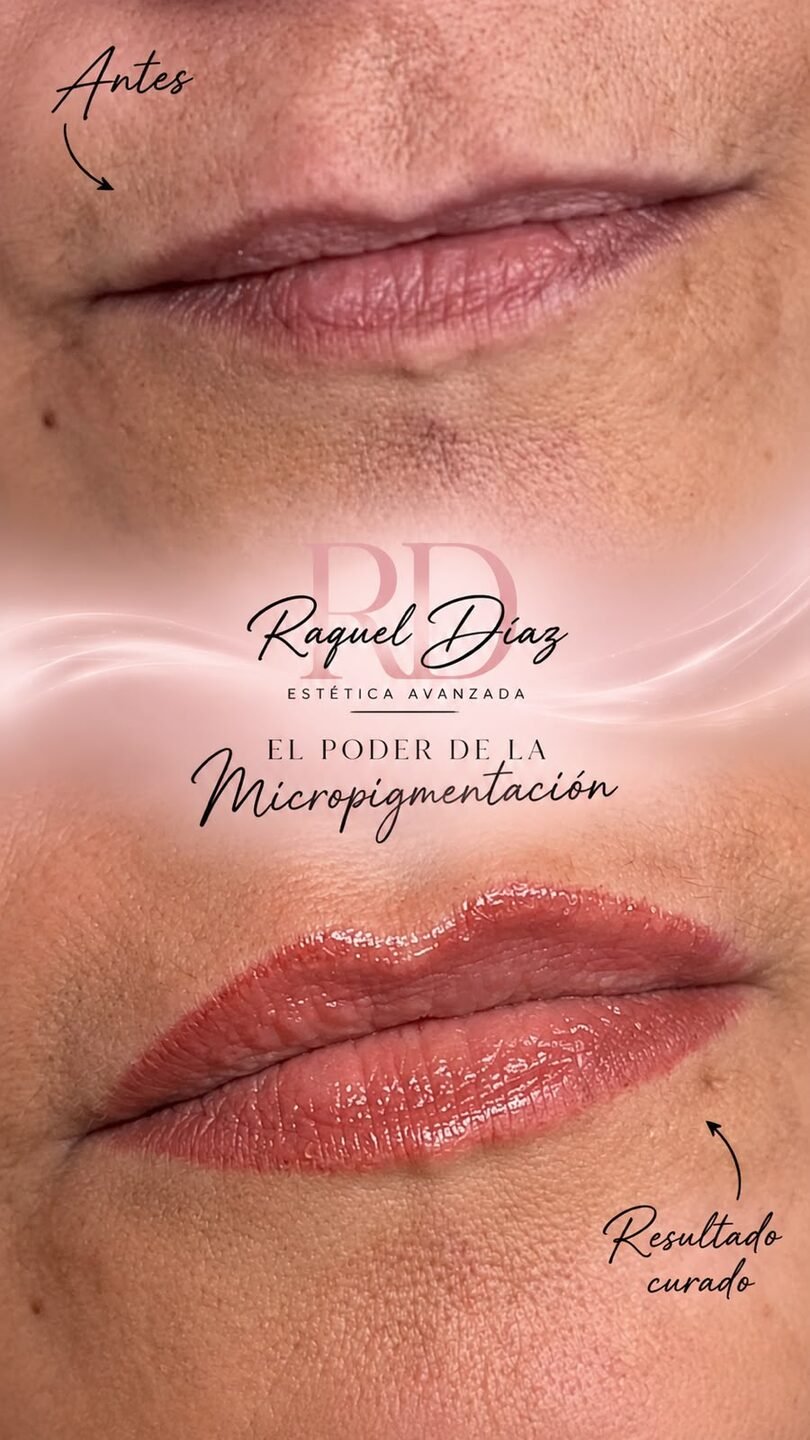 Raquel Diaz Estetica Avanzada