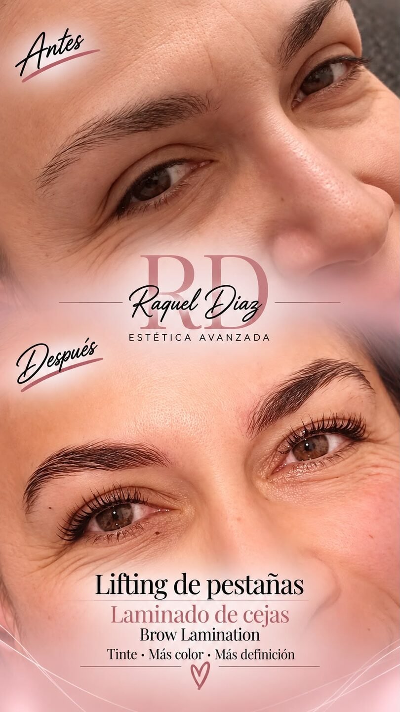 Raquel Diaz Estetica Avanzada