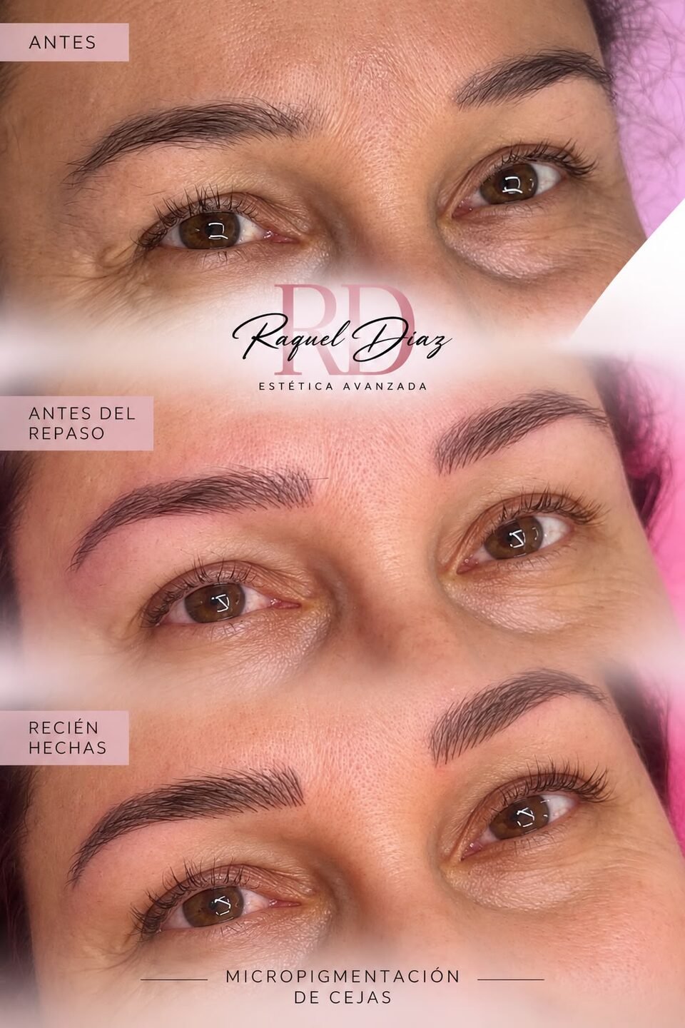 Raquel Diaz Estetica Avanzada