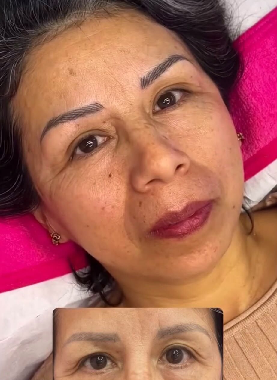 Raquel Diaz Estetica Avanzada