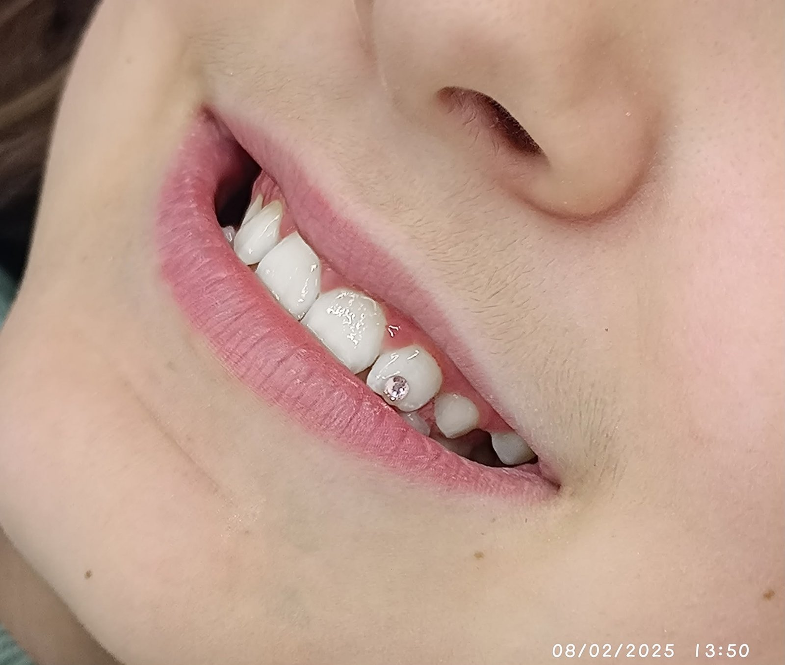 Detalle de tooth gem brillo dental