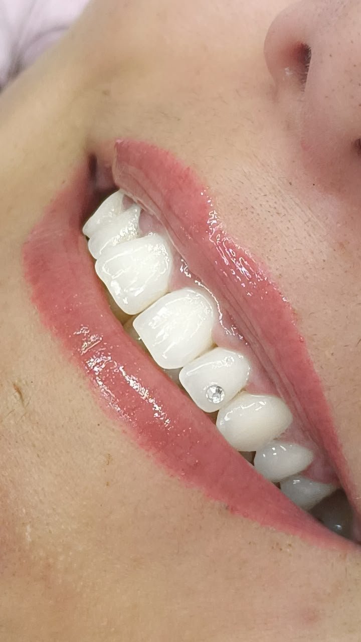 Sonrisa con tooth gem